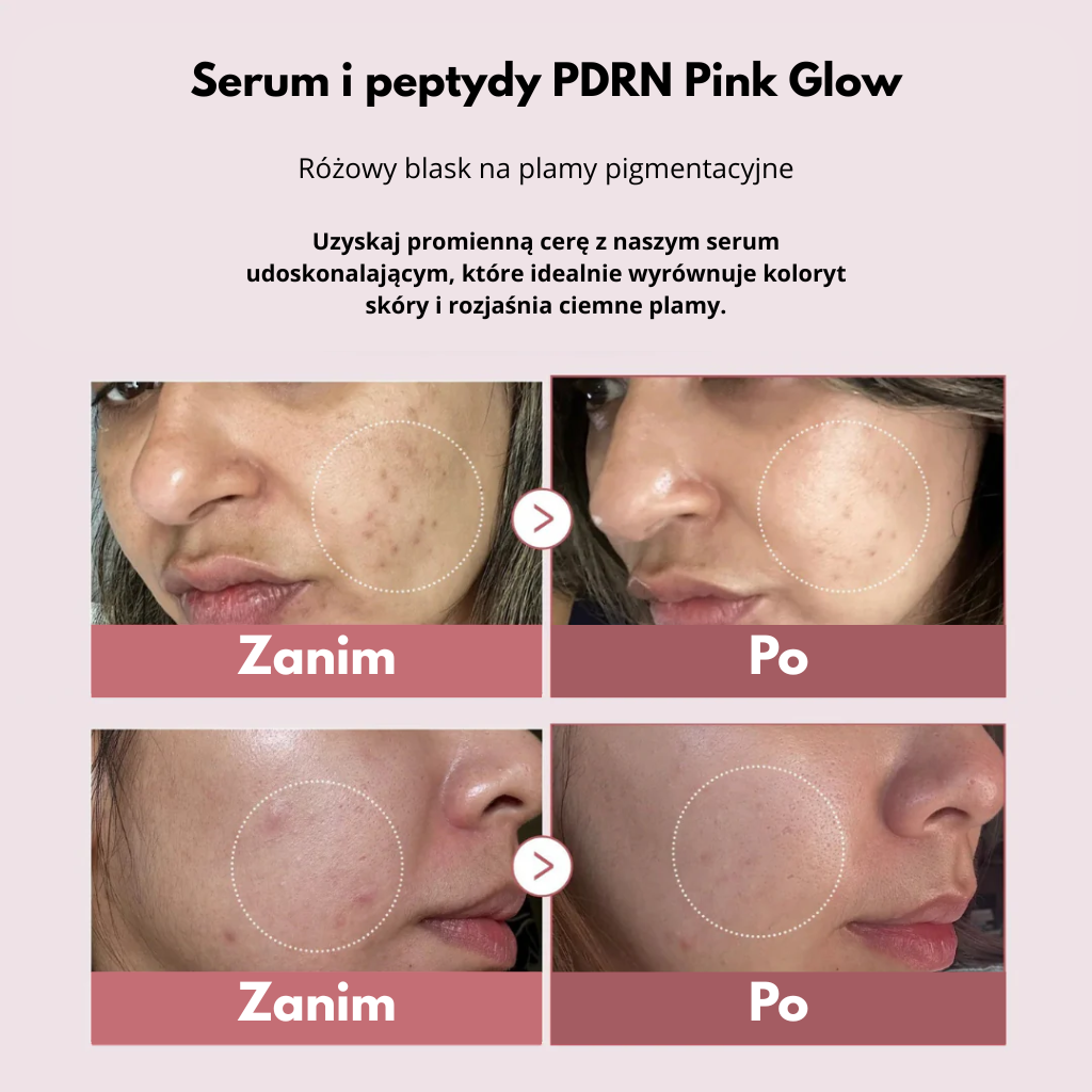 Serum rozświetlające pdrn pink glow