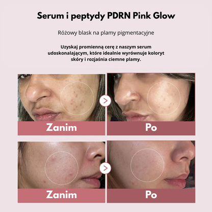 Serum rozświetlające pdrn pink glow
